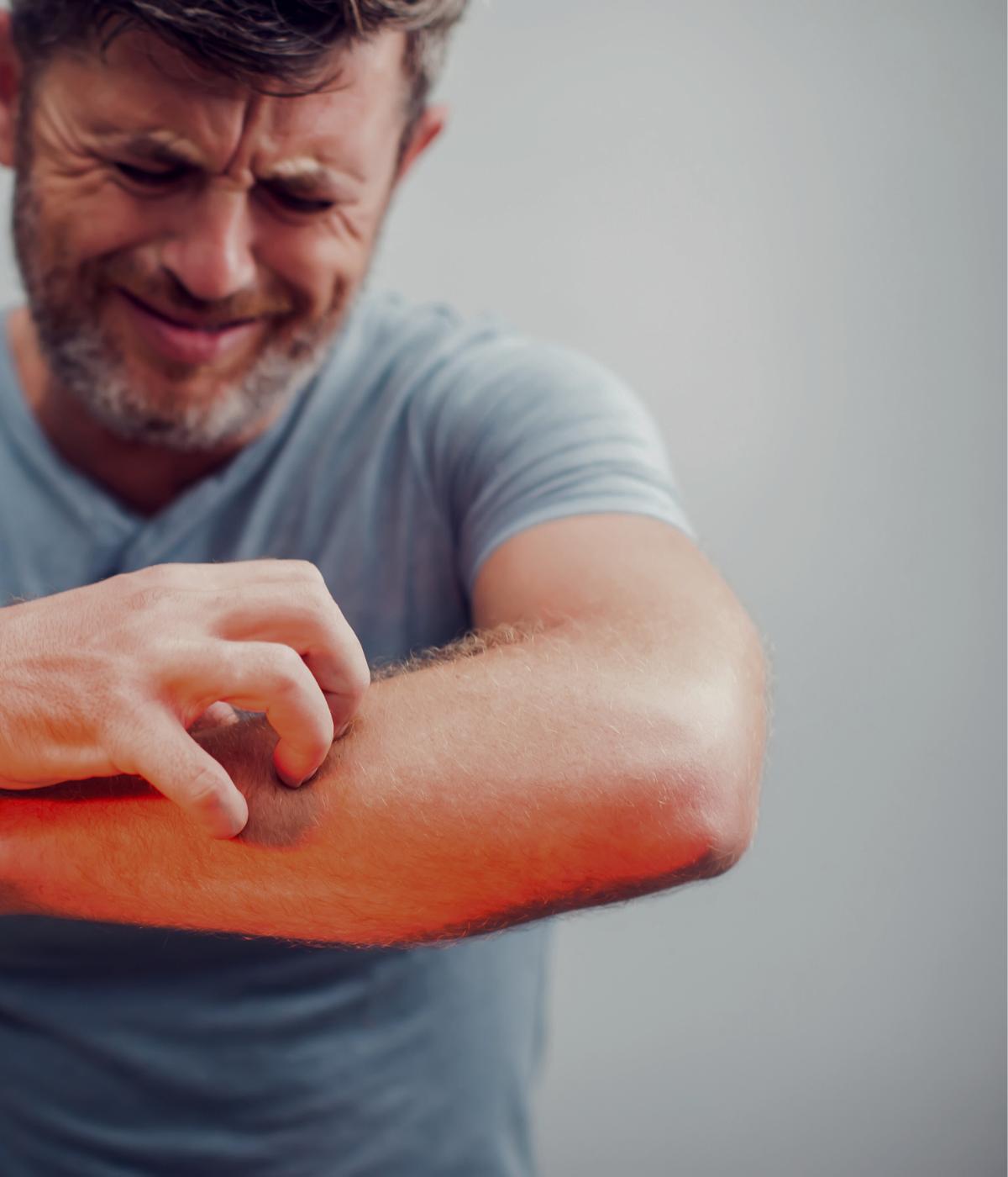 How itching can indicate a vitamin B12 deficiency – Metis Supplements